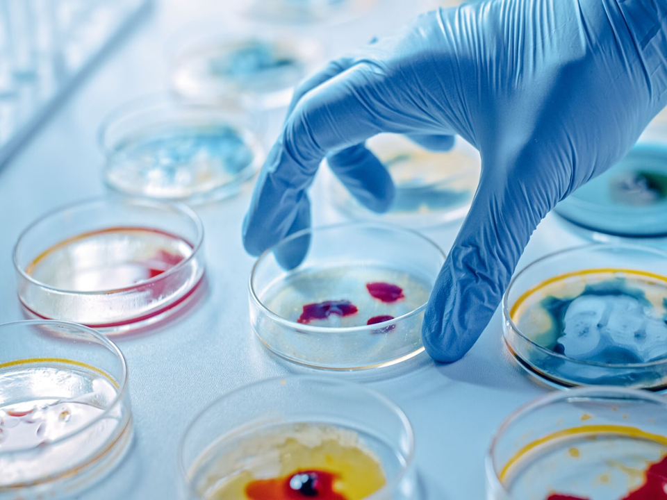 Microbial Discovery
